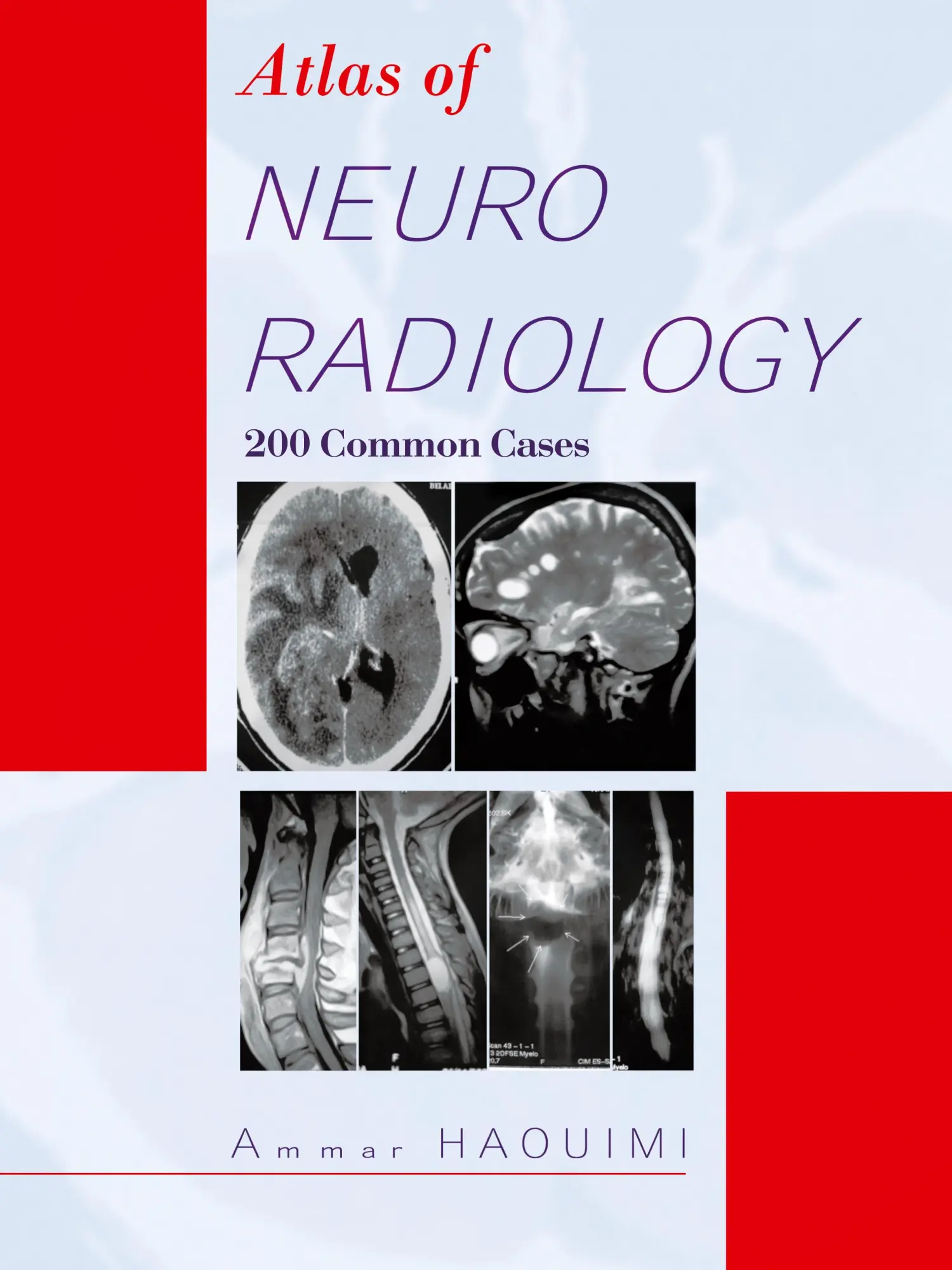 Cover: 9781426969683 | Atlas of Neuroradiology | 200 Common Cases | Ammar Haouimi | Buch