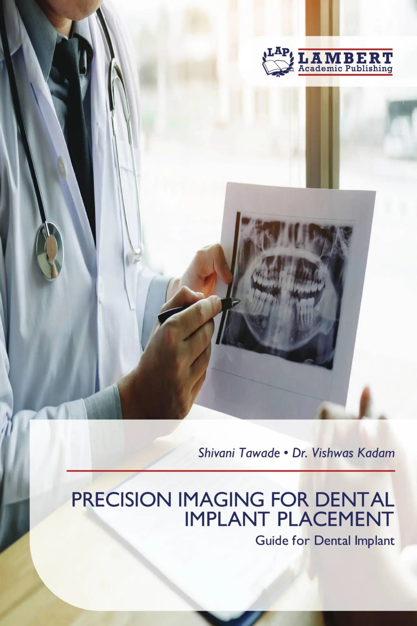 Cover: 9786209382284 | PRECISION IMAGING FOR DENTAL IMPLANT PLACEMENT | Tawade (u. a.) | Buch
