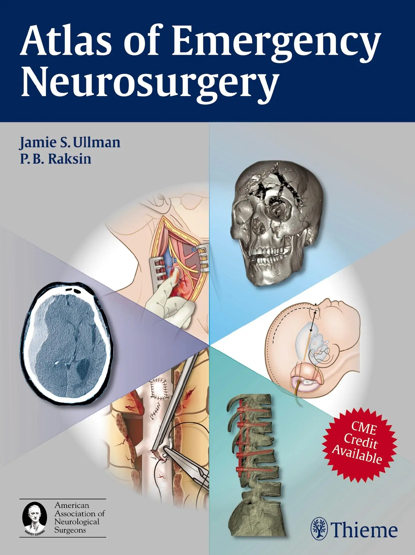 Cover: 9781604063684 | Atlas of Emergency Neurosurgery | Jamie S Ullman (u. a.) | Buch | 2015