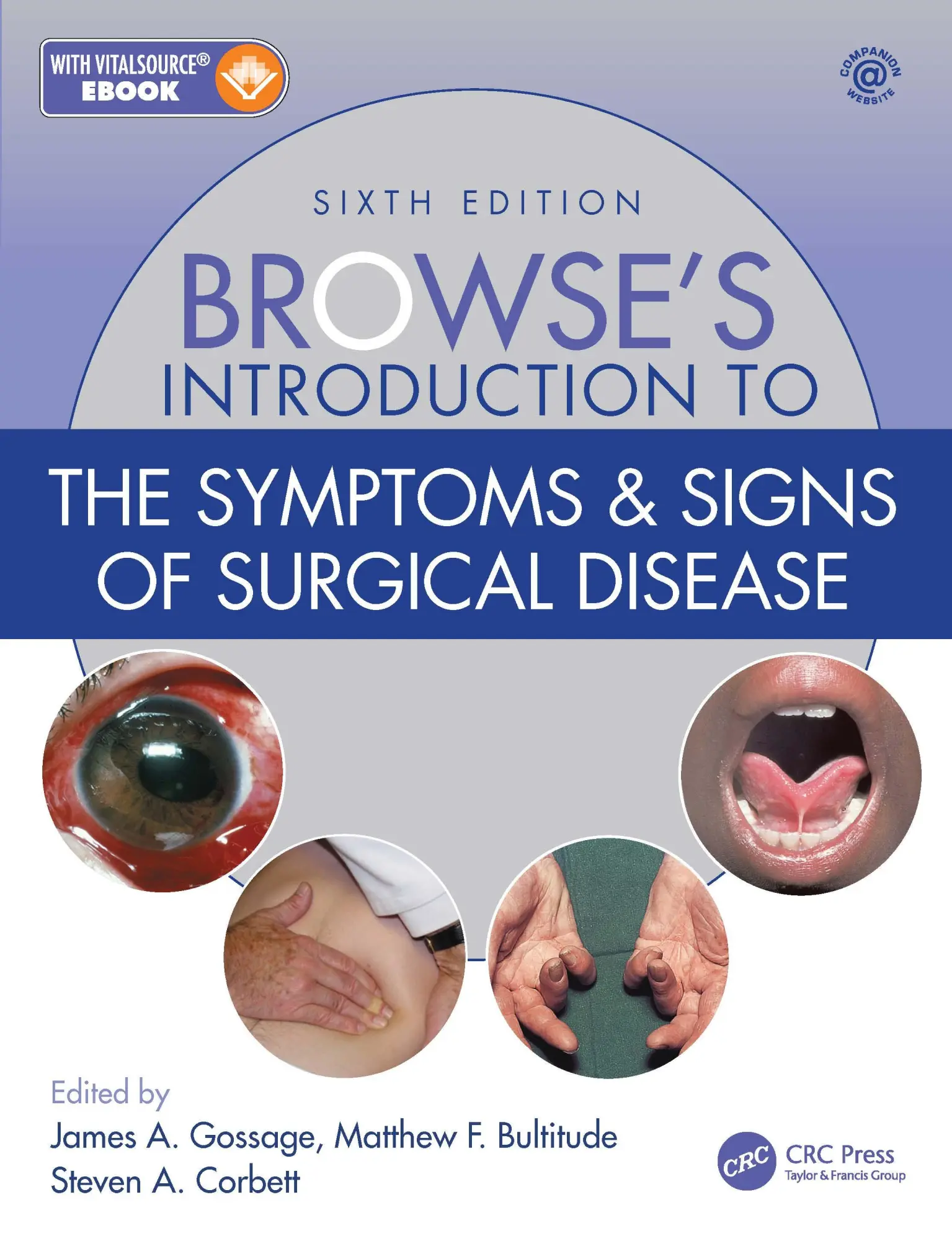 Cover: 9781138330085 | Browse's Introduction to the Symptoms &amp; Signs of Surgical Disease