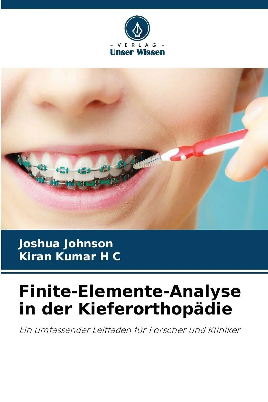 Cover: 9786200690685 | Finite-Elemente-Analyse in der Kieferorthopädie | Johnson (u. a.)