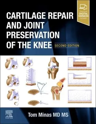 Cover: 9780323698085 | Cartilage Repair and Joint Preservation of the Knee | Tom Minas | Buch