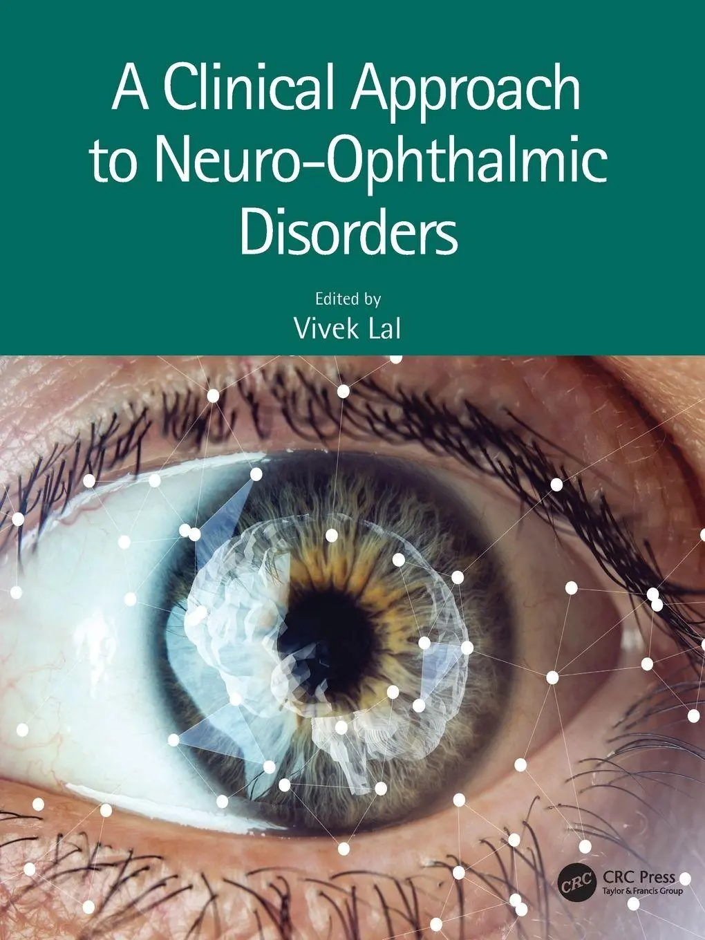 Cover: 9781032251486 | A Clinical Approach to Neuro-Ophthalmic Disorders | Vivek Lal | Buch