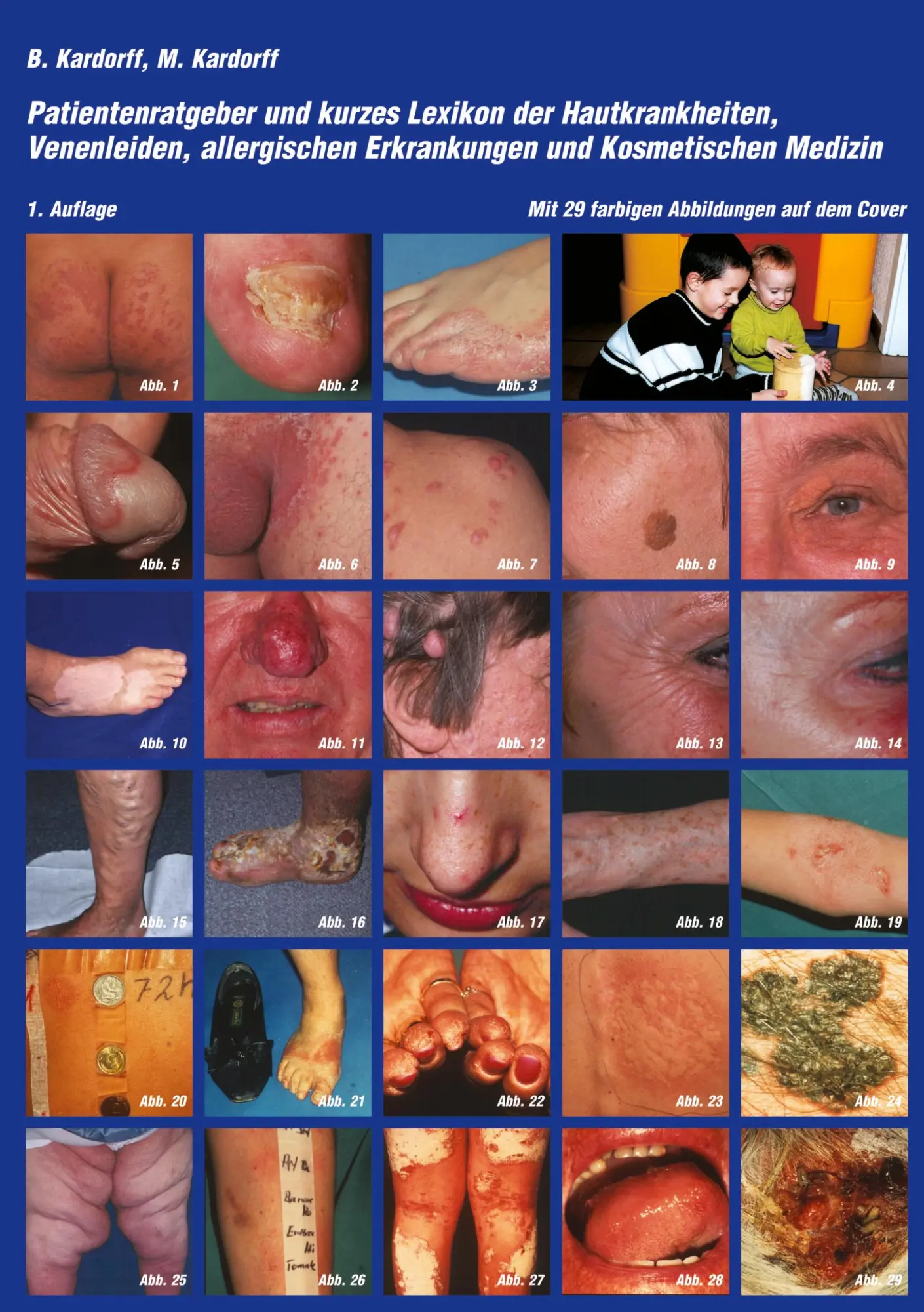 Cover: 9783831132386 | Patientenratgeber und kurzes Lexikon der Hautkrankheiten,...