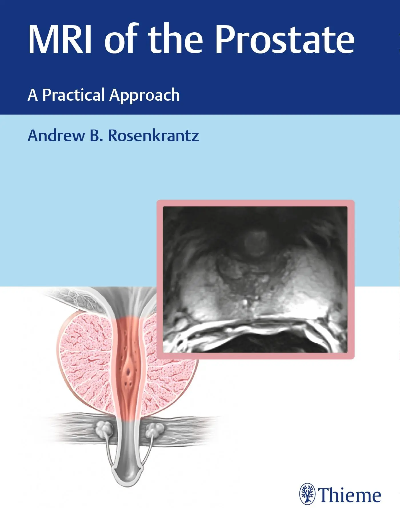 Cover: 9781626232686 | MRI of the Prostate | A Practical Approach | Andrew Rosenkrantz | Buch