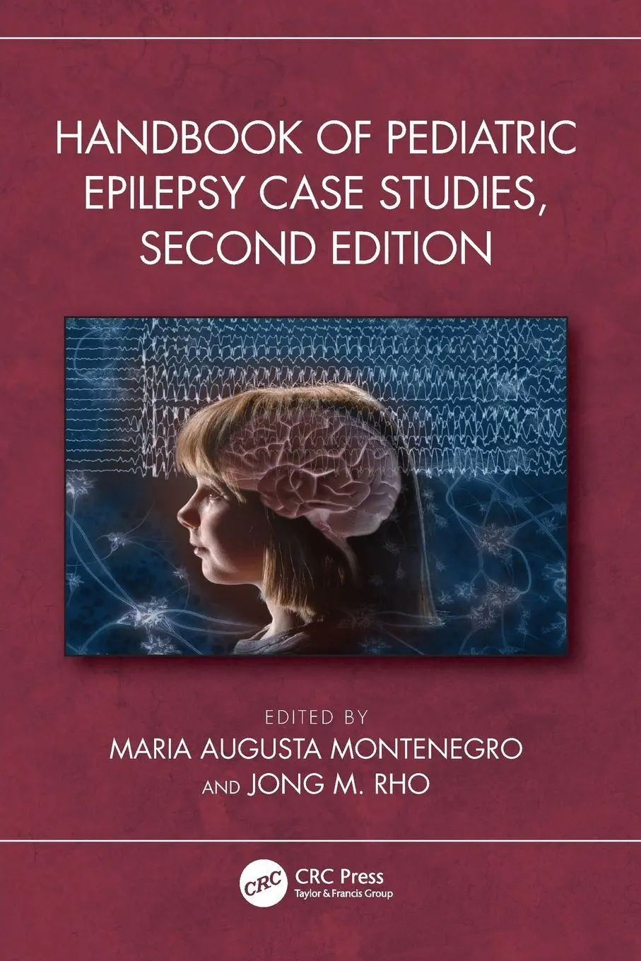Cover: 9781032283586 | Handbook of Pediatric Epilepsy Case Studies, Second Edition | Buch