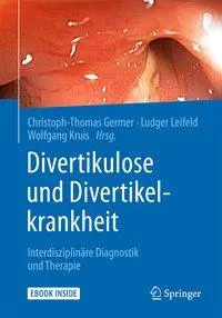 Cover: 9783662535486 | Divertikulose und Divertikelkrankheit | Christoph-Thomas Germer | IX