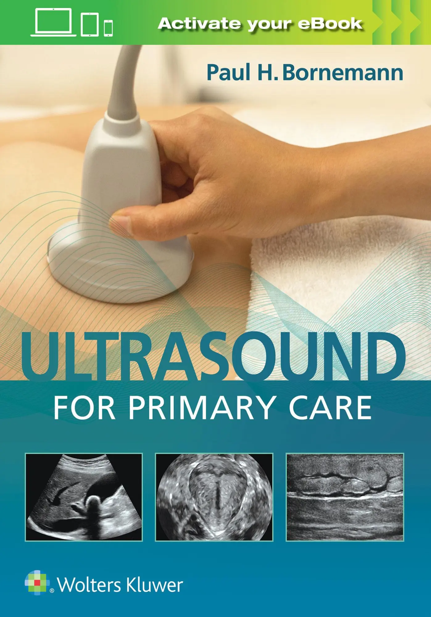 Cover: 9781496366986 | Ultrasound for Primary Care | Paul H. Bornemann | Buch | Gebunden