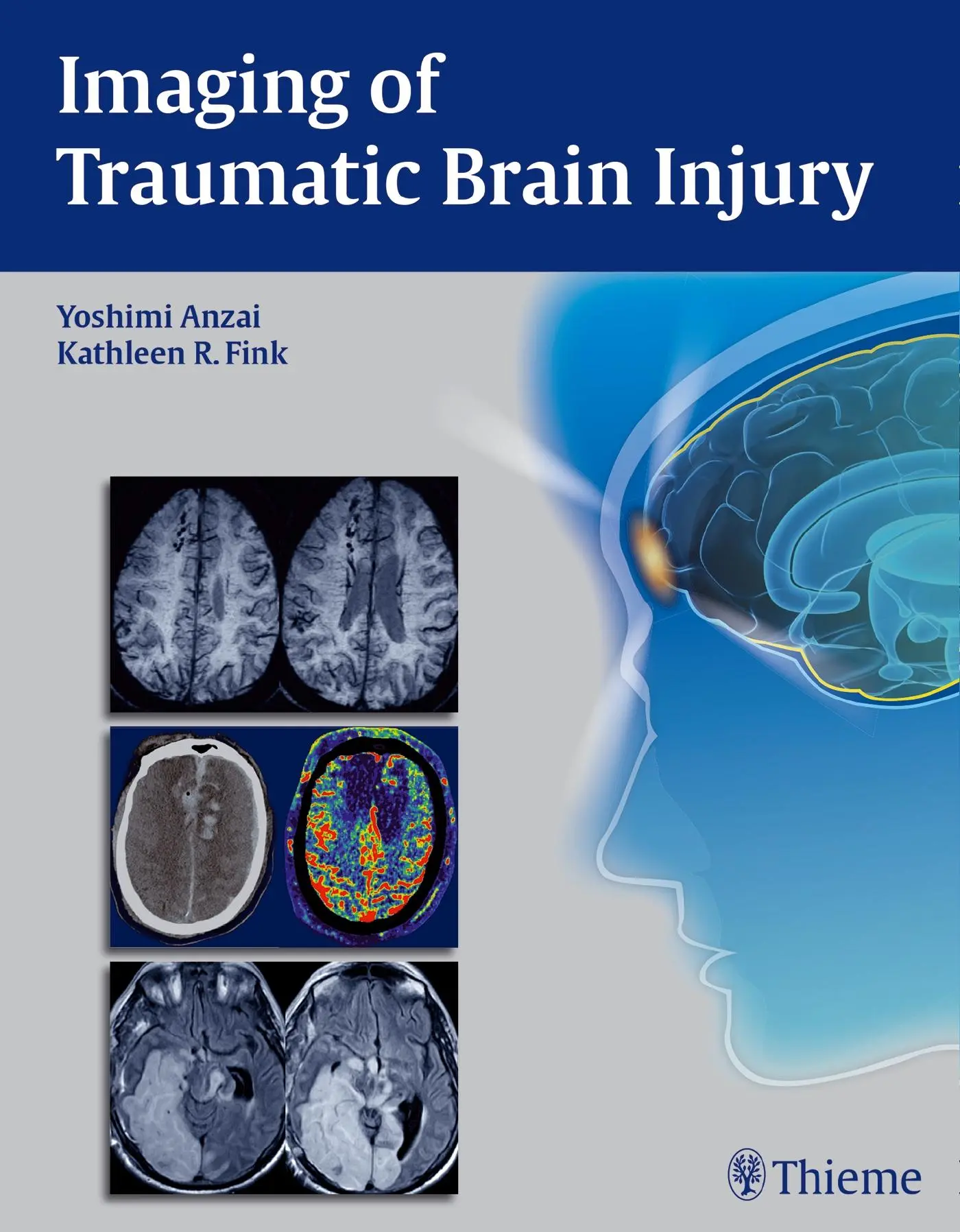 Cover: 9781604067286 | Imaging of Traumatic Brain Injury | Yoshimi Anzai (u. a.) | Buch