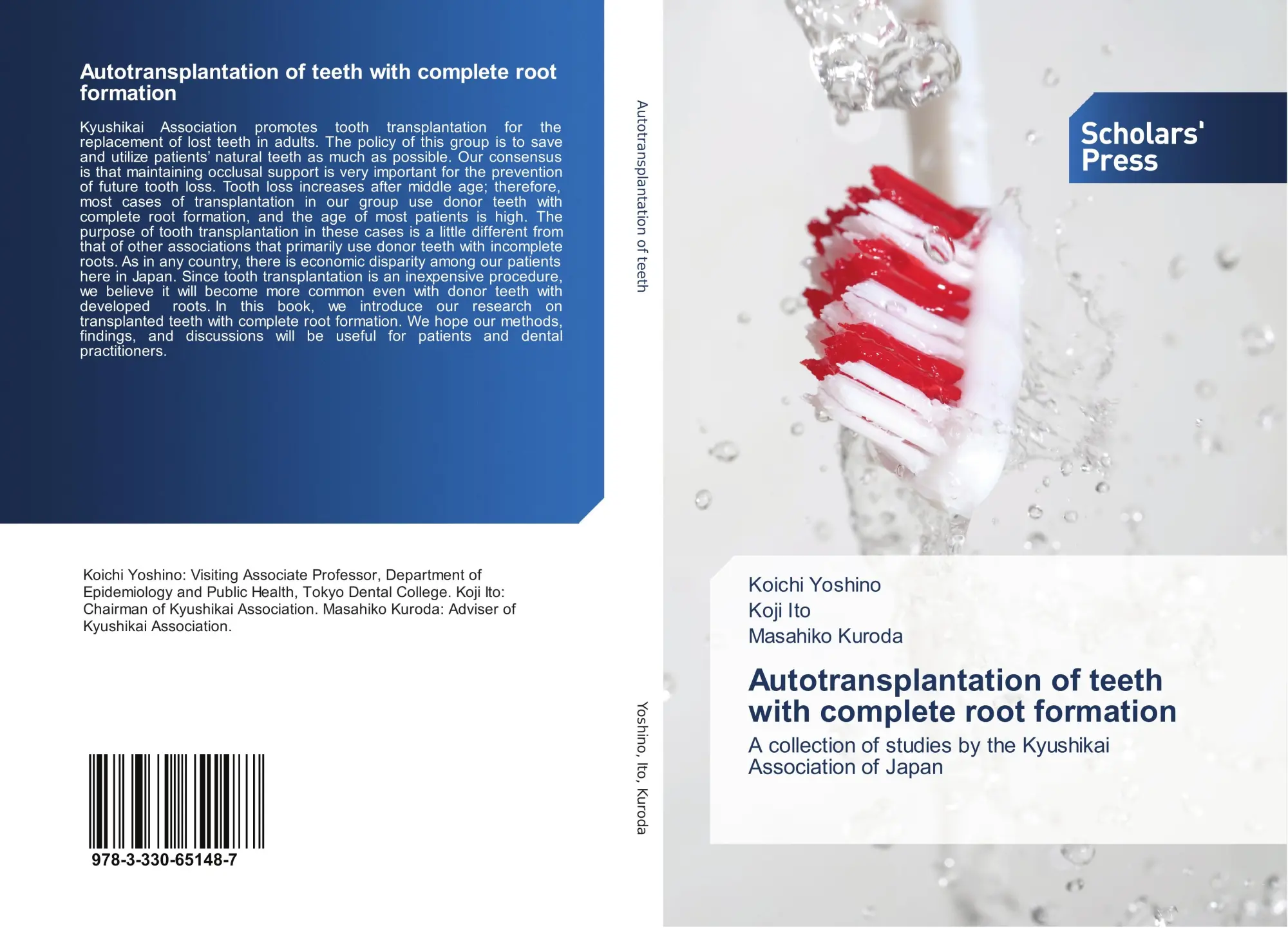 Cover: 9783330651487 | Autotransplantation of teeth with complete root formation | Buch