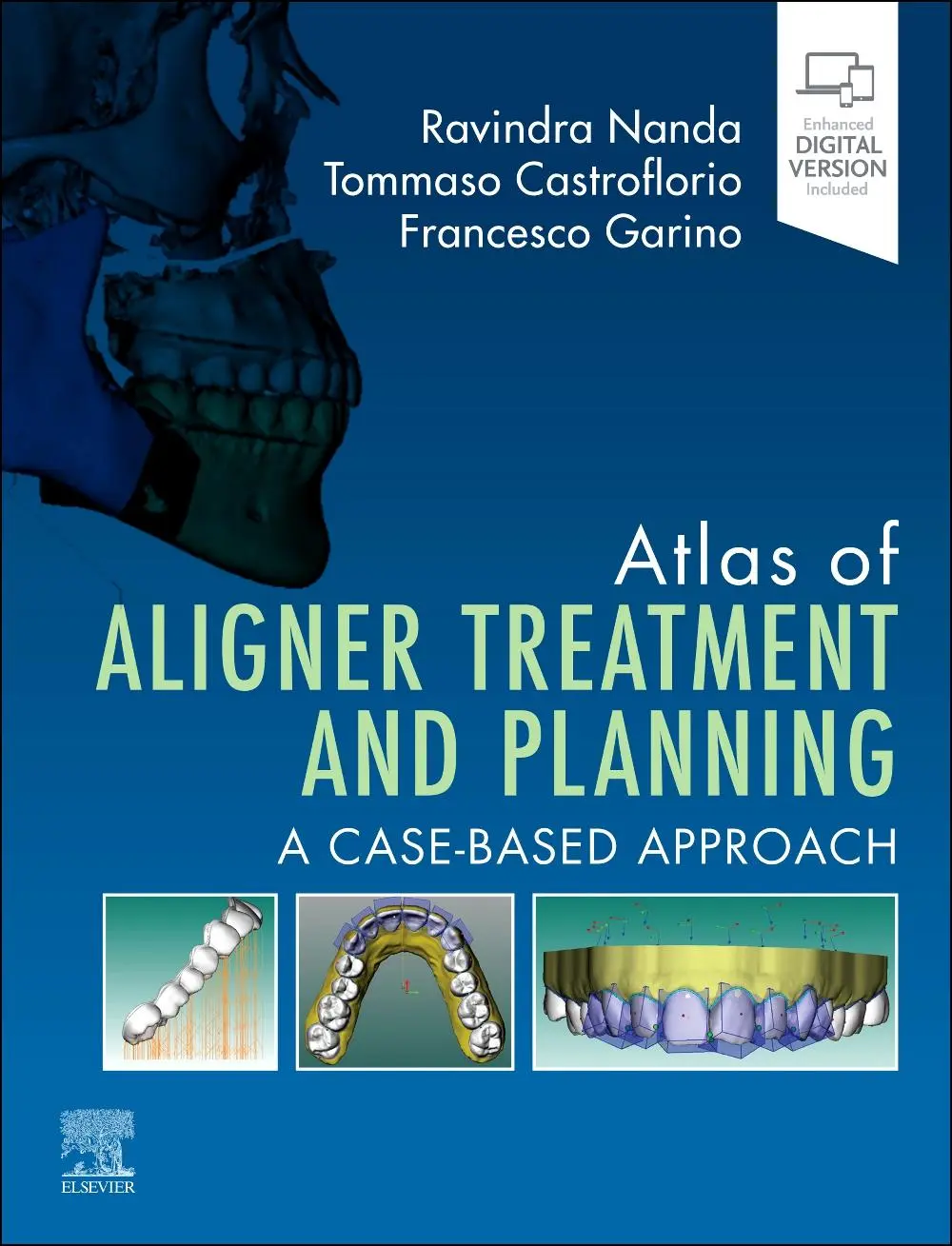 Cover: 9780443116087 | Atlas of Aligner Treatment and Planning | A Case-Based Approach | Buch