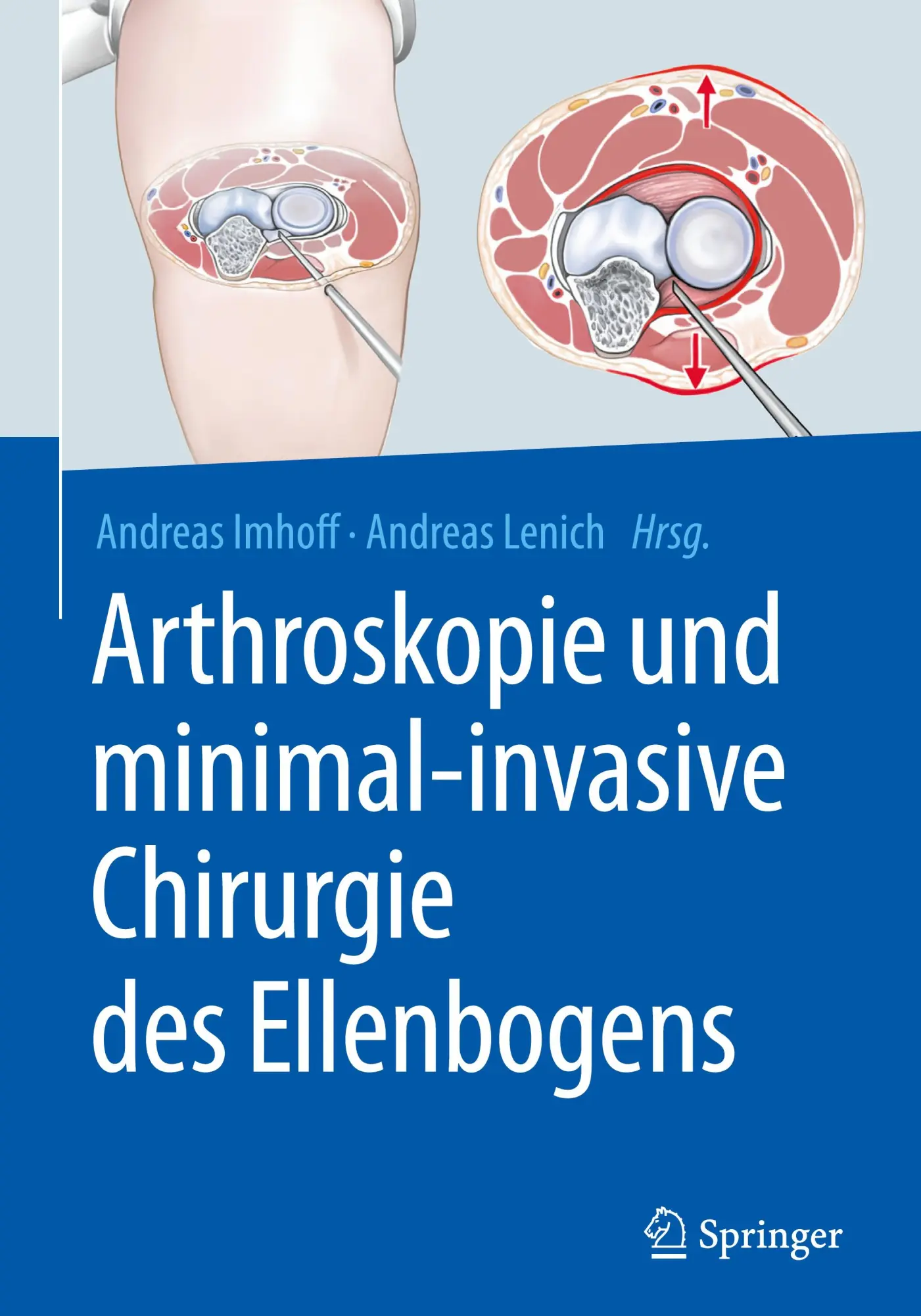 Cover: 9783662566787 | Arthroskopie und minimal-invasive Chirurgie des Ellenbogens | Buch
