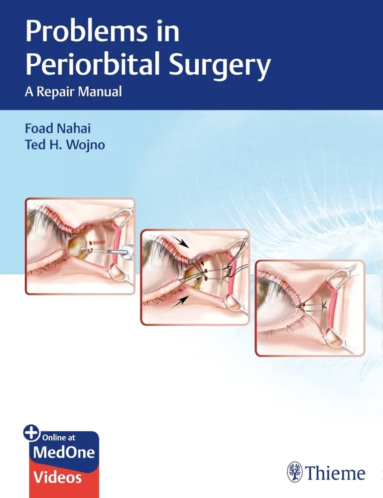 Cover: 9781626237087 | Problems in Periorbital Surgery | Foad Nahai (u. a.) | Bundle | 2019