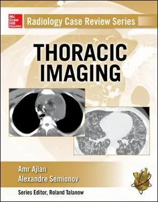 Cover: 9780071818087 | Radiology Case Review Series: Thoracic Imaging | Amr M Ajlan (u. a.)