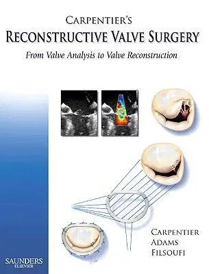 Cover: 9780721691688 | Carpentier's Reconstructive Valve Surgery | Carpentier (u. a.) | Buch