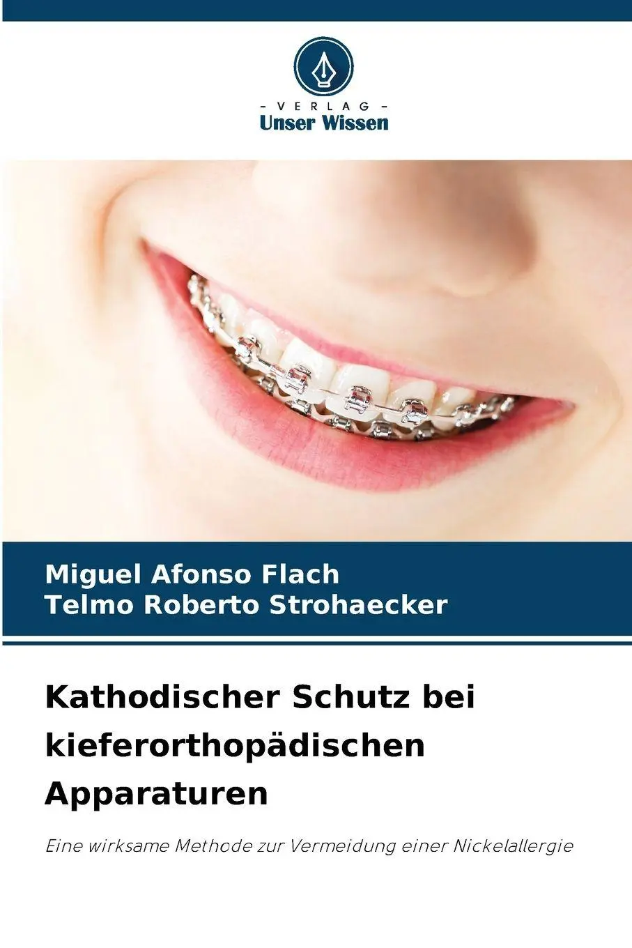 Cover: 9786209122088 | Kathodischer Schutz bei kieferorthopädischen Apparaturen | Taschenbuch