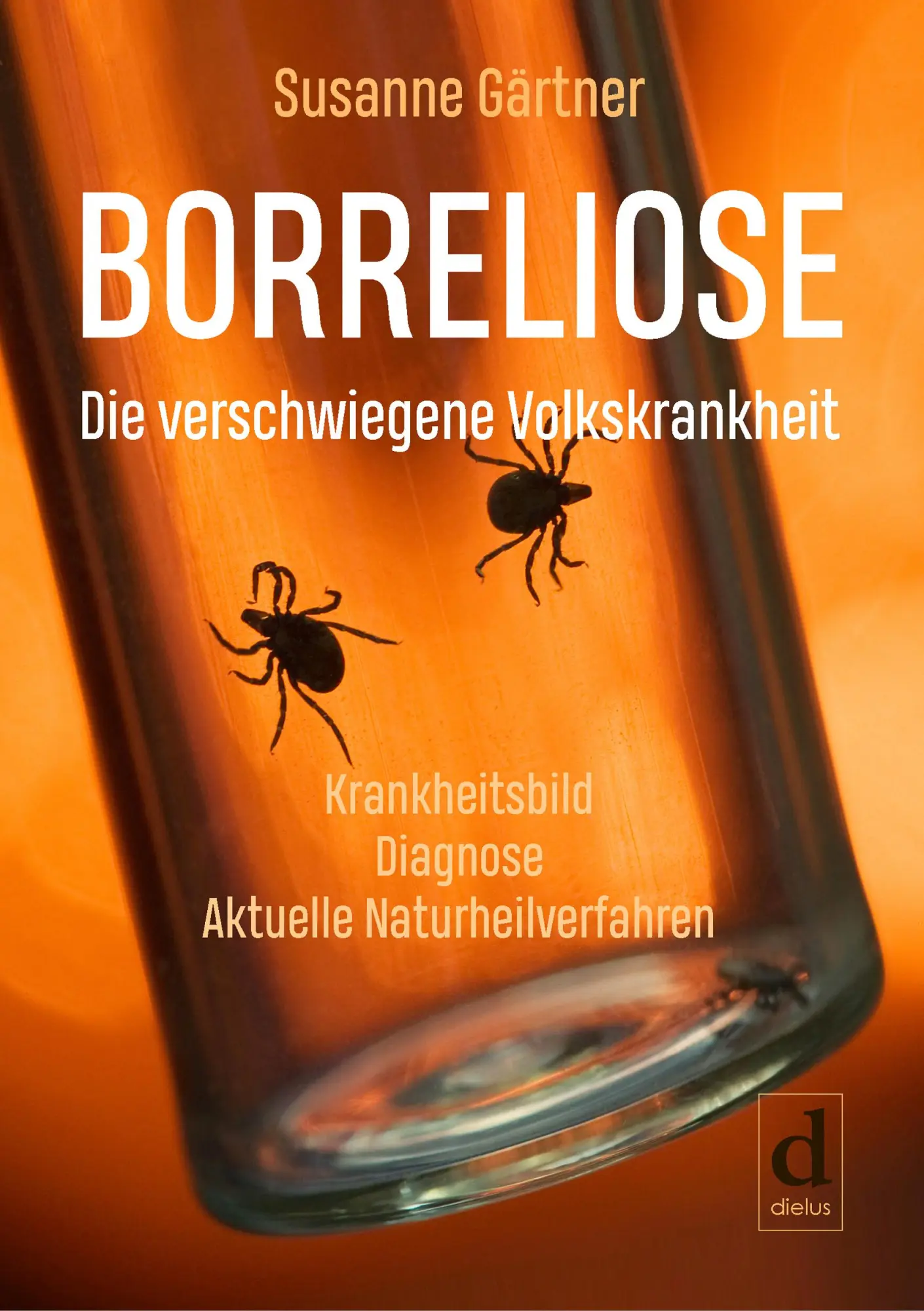 Cover: 9783981892888 | Borreliose - Die verschwiegene Volkskrankheit | Susanne Gärtner | Buch