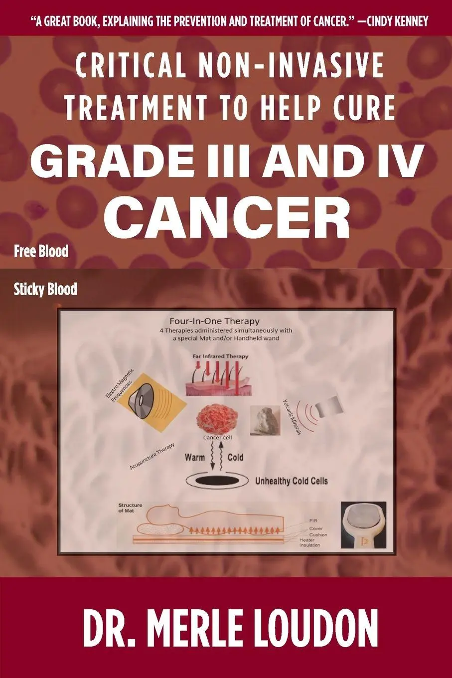 Cover: 9781952685088 | Critical Non-Invasive Treatment to Cure Grade III and IV Cancer | Buch