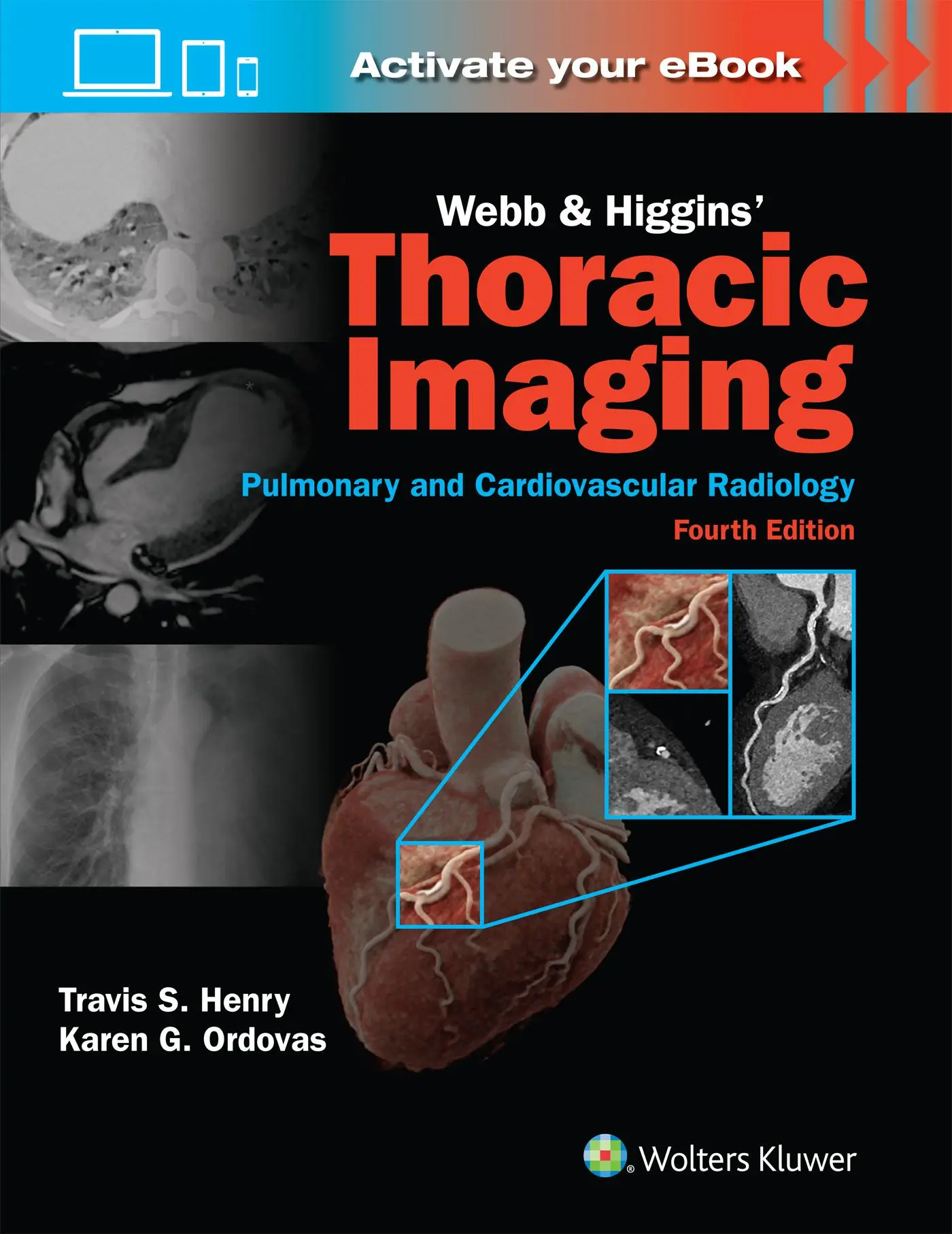 Cover: 9781975199388 | Webb &amp; Higgins Thoracic Imaging: Print + eBook with Multimedia | Buch