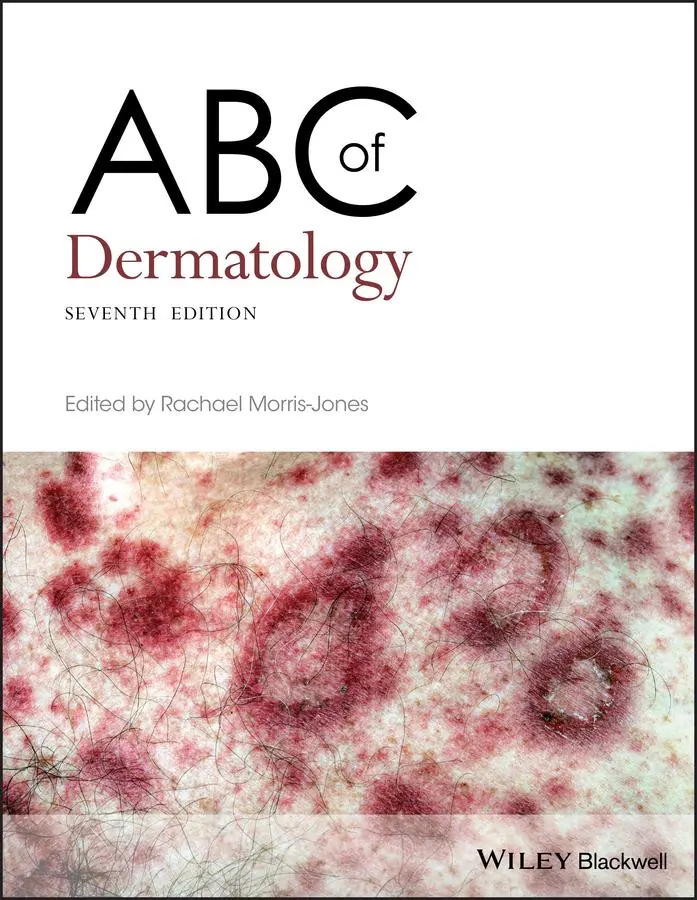 Cover: 9781119488989 | ABC of Dermatology | Rachael Morris-Jones | Taschenbuch | ABC Series