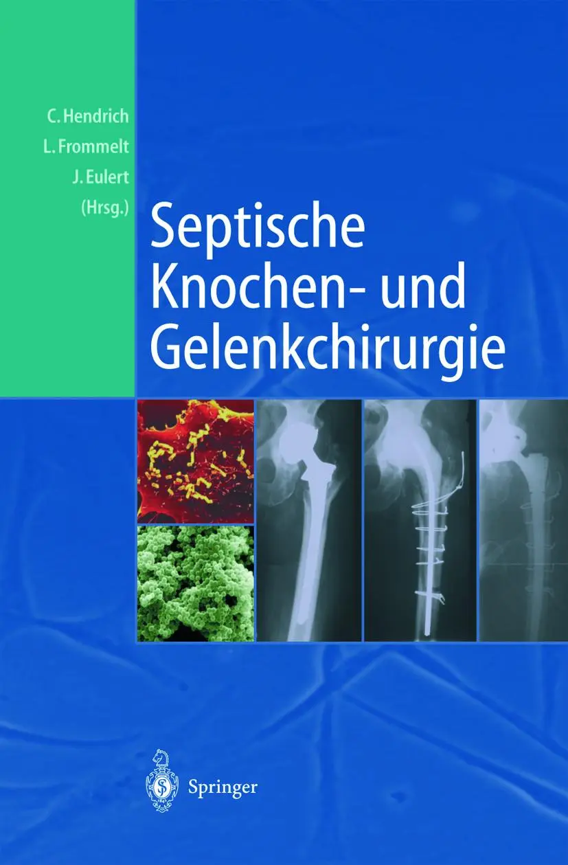Cover: 9783642639289 | Septische Knochen-und Gelenkchirurgie | Christian Hendrich (u. a.) | x
