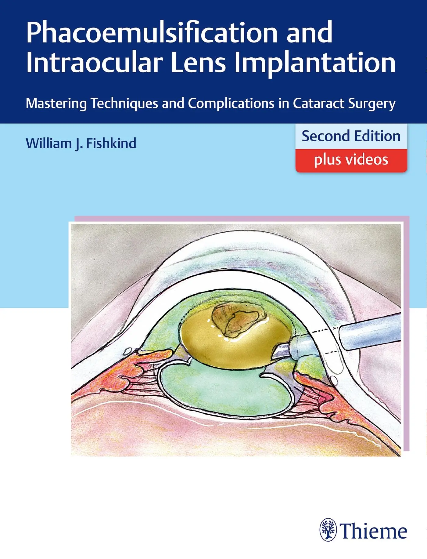 Cover: 9781626231290 | Phacoemulsification and Intraocular Lens Implantation | Fishkind