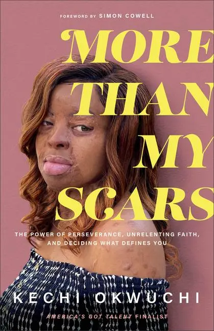 Cover: 9781540901590 | More Than My Scars | Kechi Okwuchi | Taschenbuch | Englisch | 2022