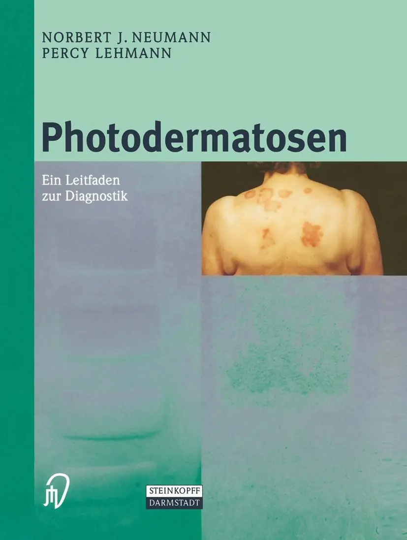 Cover: 9783798512290 | Photodermatosen | Ein Leitfaden zur Diagnostik | Percy Lehmann (u. a.)