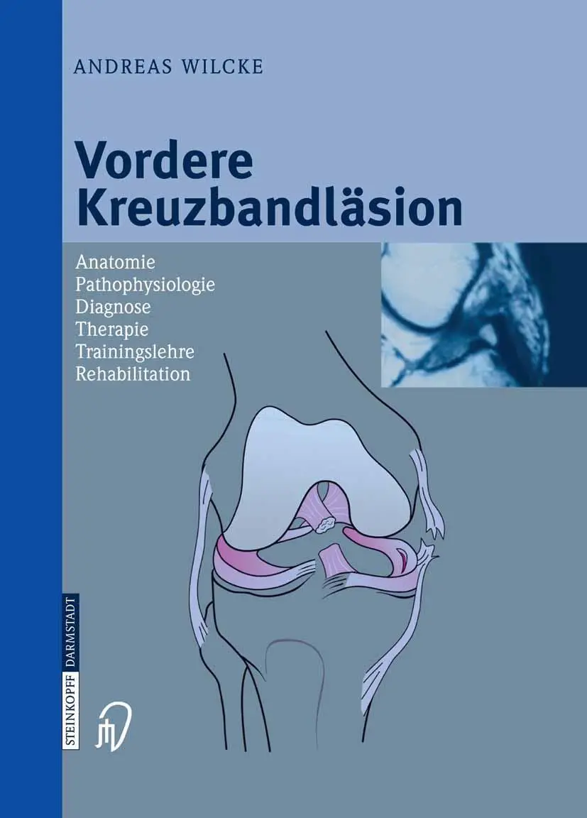 Cover: 9783642623790 | Vordere Kreuzbandläsion | Andreas Wilcke | Taschenbuch | xi | Deutsch