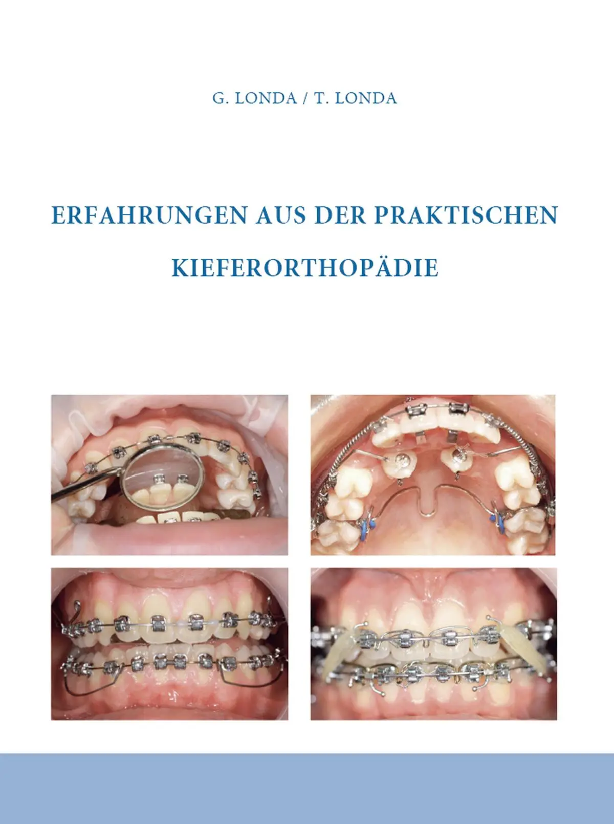 Cover: 9783863865290 | Erfahrungen aus der praktischen Kieferorthopädie | Londa (u. a.)