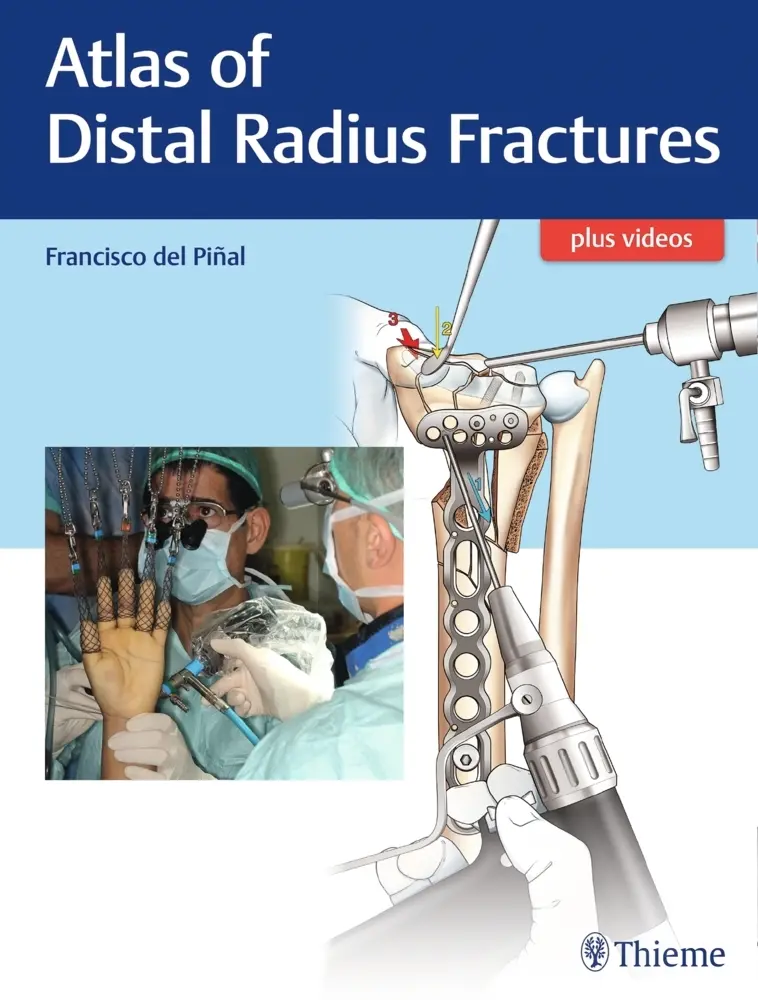 Cover: 9781626236790 | Atlas of Distal Radius Fractures | Plus videos | Francisco del Piñal