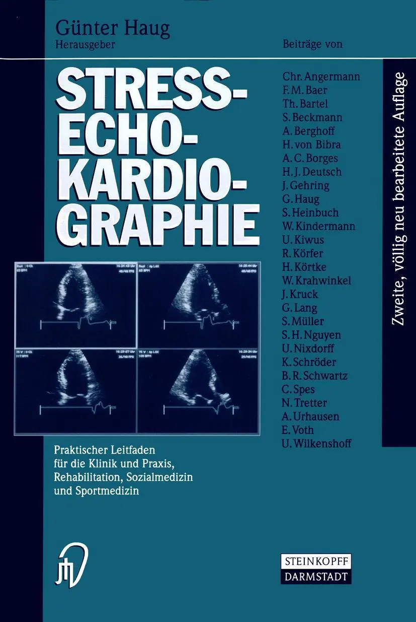 Cover: 9783642638190 | Streß-echokardiographie | Guenter Haug | Taschenbuch | xx | Deutsch
