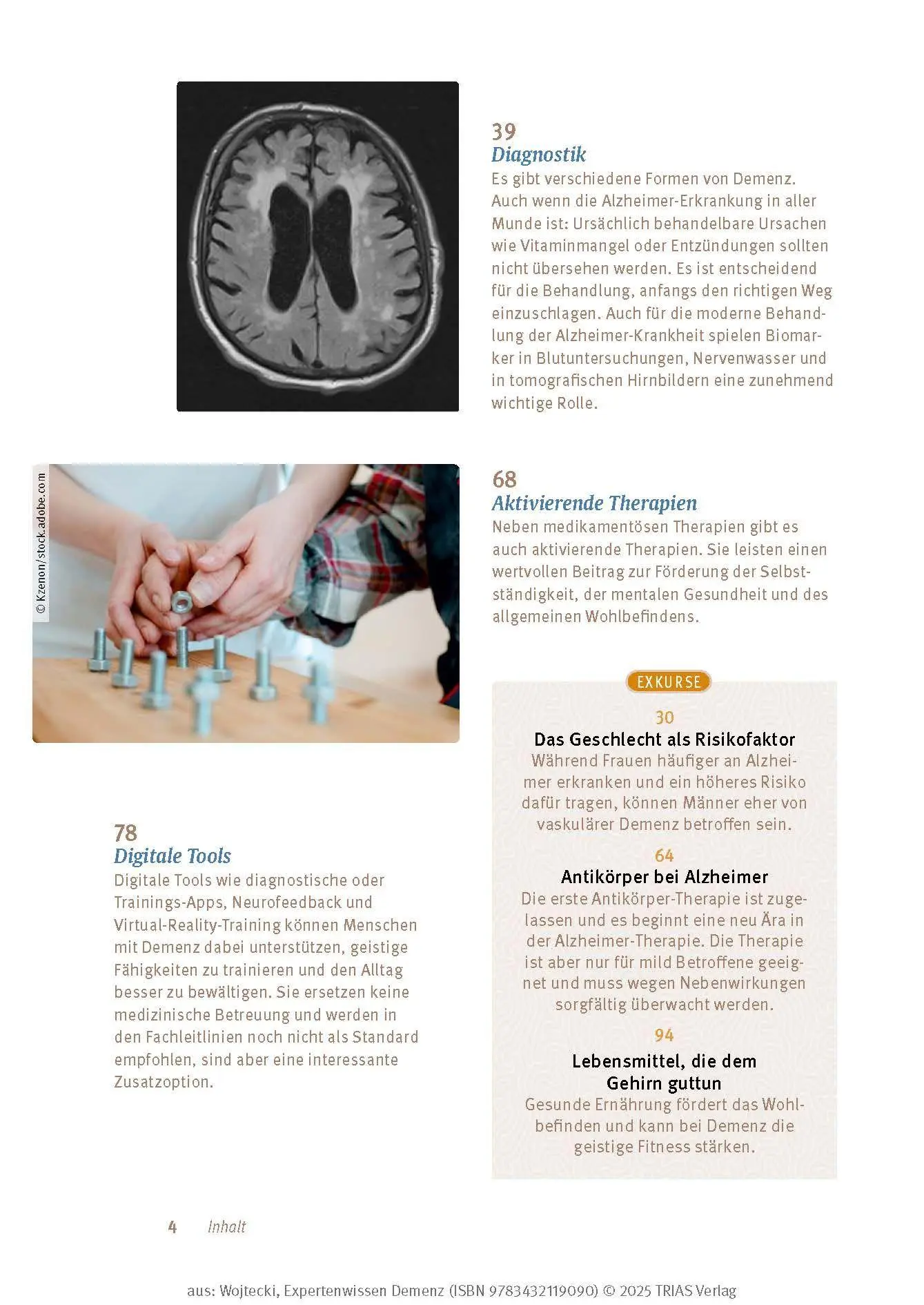 Bild: 9783432119090 | Expertenwissen: Demenz | Lars Wojtecki (u. a.) | Taschenbuch | 160 S.