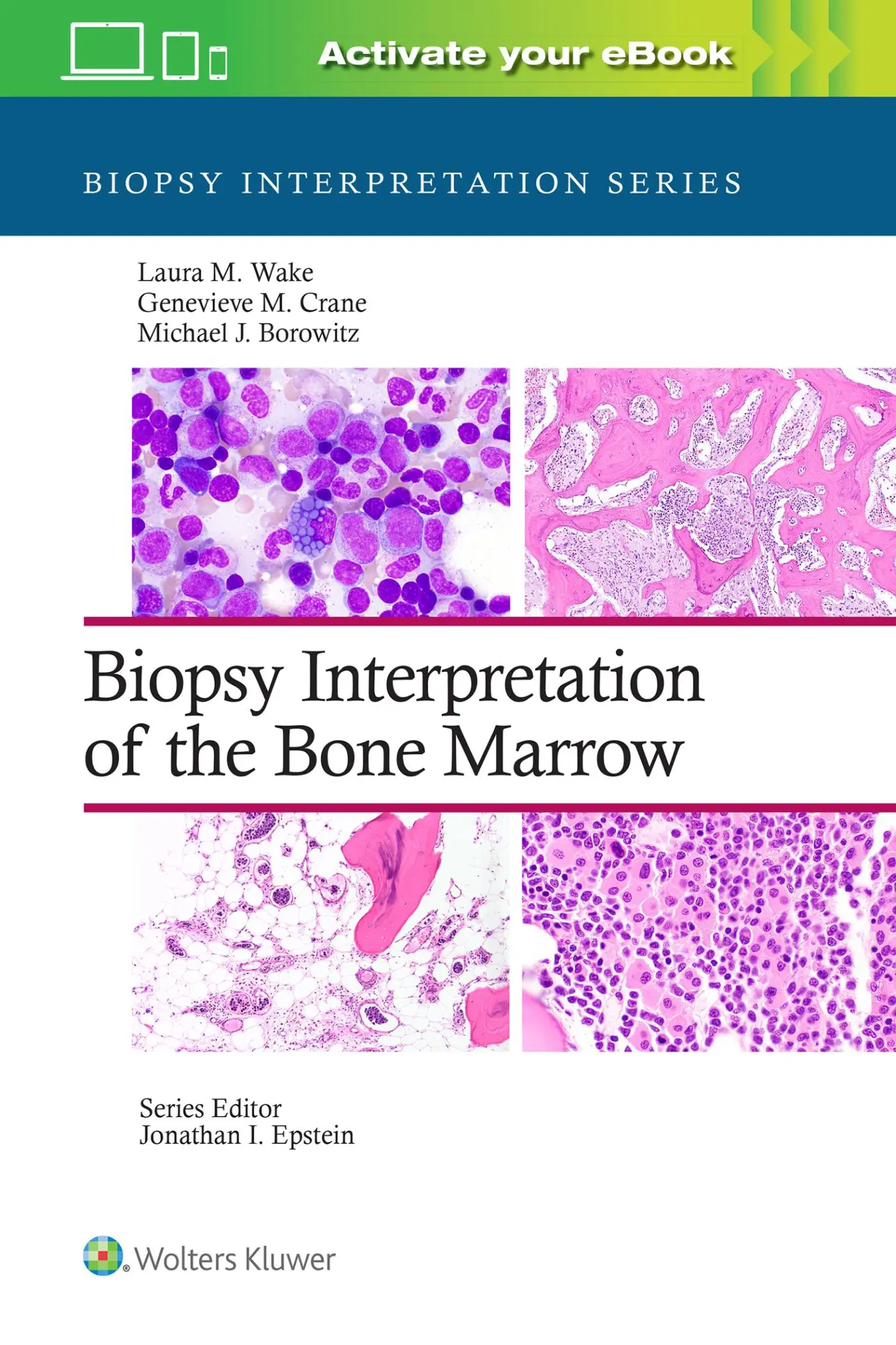 Cover: 9781496300591 | Biopsy Interpretation of the Bone Marrow: Print + eBook with...