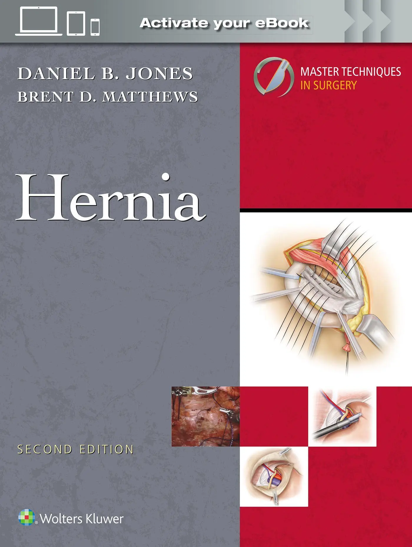 Cover: 9781975222291 | Master Techniques in Surgery: Hernia: Print + eBook with Multimedia