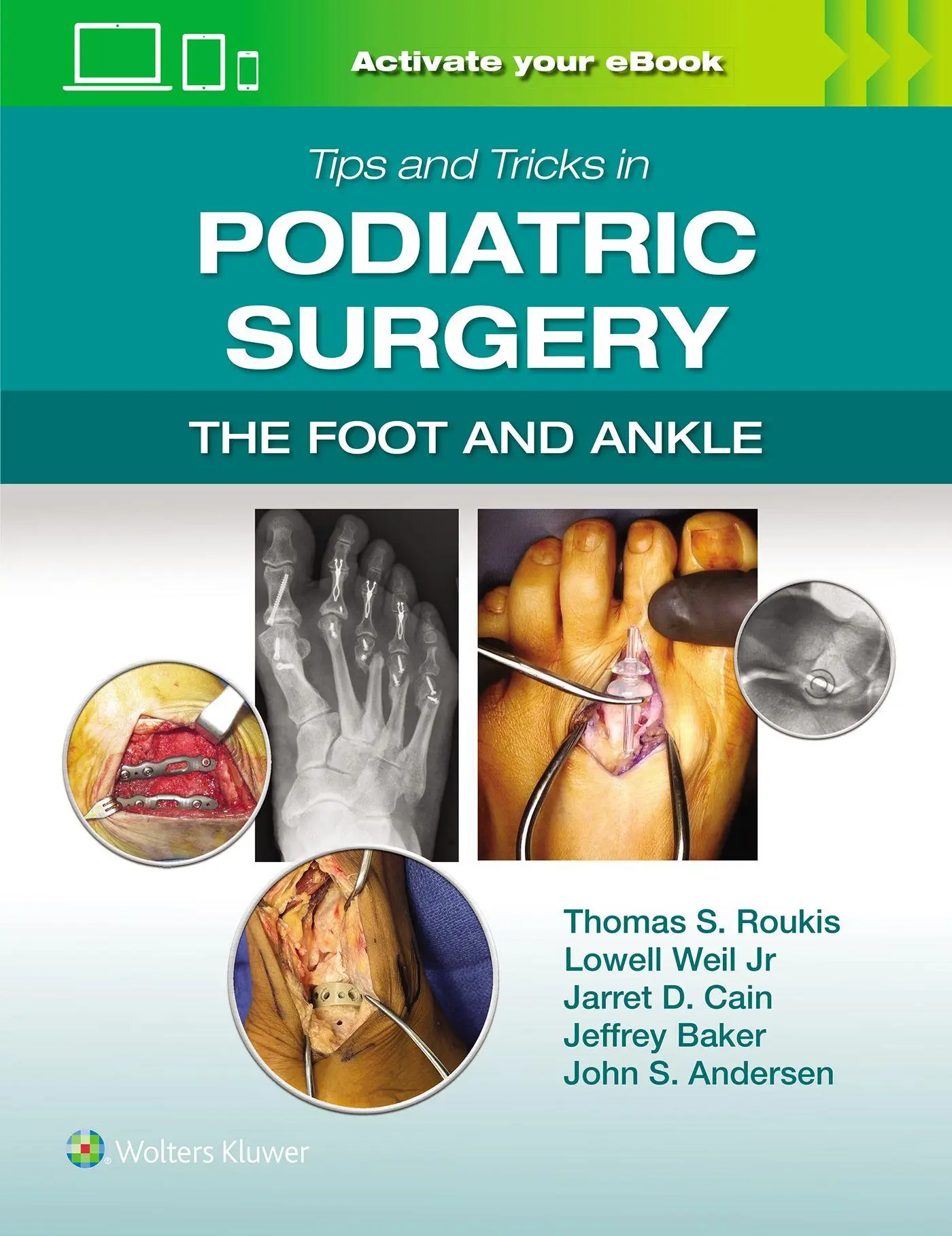 Cover: 9781975240592 | Tips and Tricks in Podiatric Surgery: The Foot and Ankle: Print +...