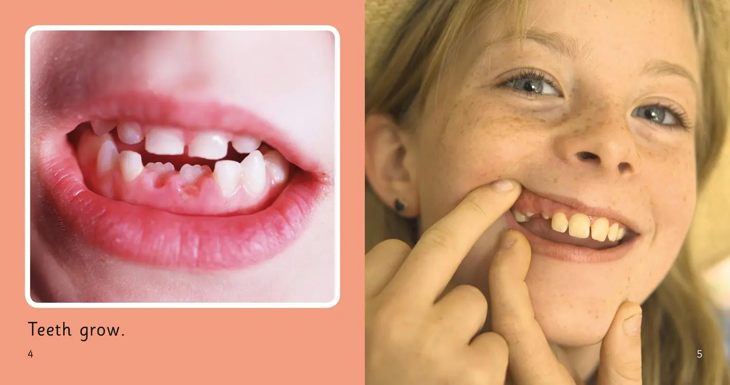 Bild: 9780007412792 | Teeth | Band 01a/Pink a | Nick Arnold | Taschenbuch | Englisch | 2011