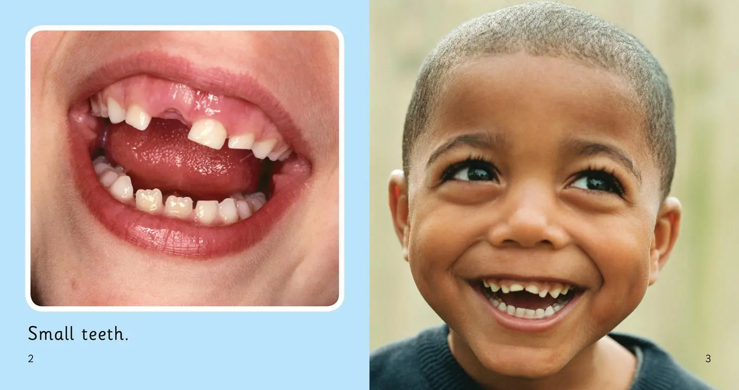 Bild: 9780007412792 | Teeth | Band 01a/Pink a | Nick Arnold | Taschenbuch | Englisch | 2011