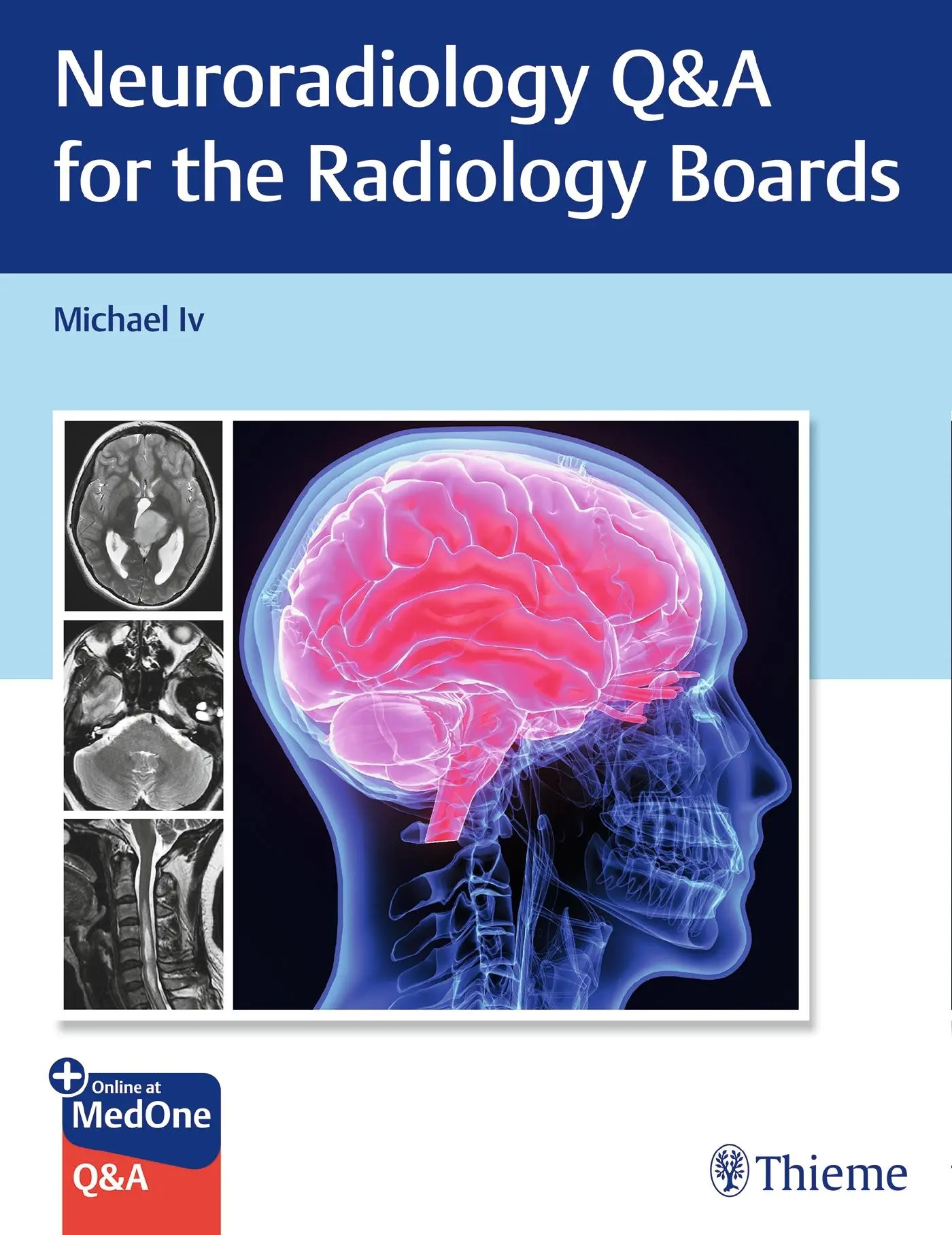 Cover: 9781684205592 | Neuroradiology Q&amp;A for the Radiology Boards | Michael Iv | Taschenbuch