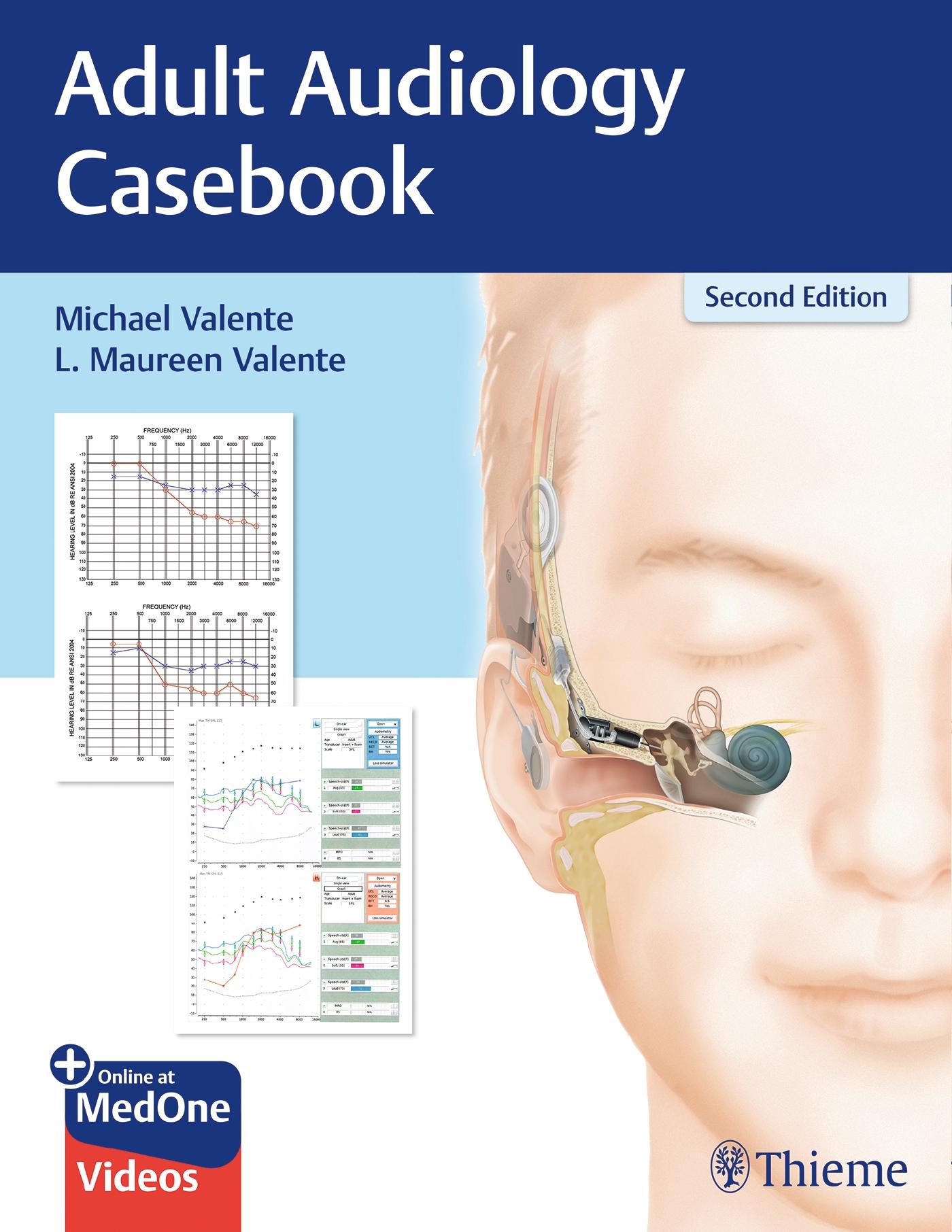 Cover: 9781626237292 | Adult Audiology Casebook | Michael Valente (u. a.) | Taschenbuch