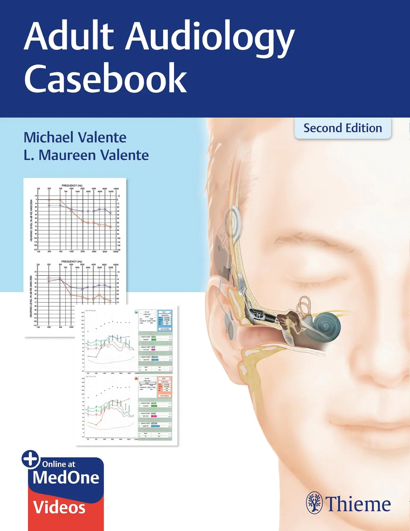 Cover: 9781626237292 | Adult Audiology Casebook | Michael Valente (u. a.) | Taschenbuch