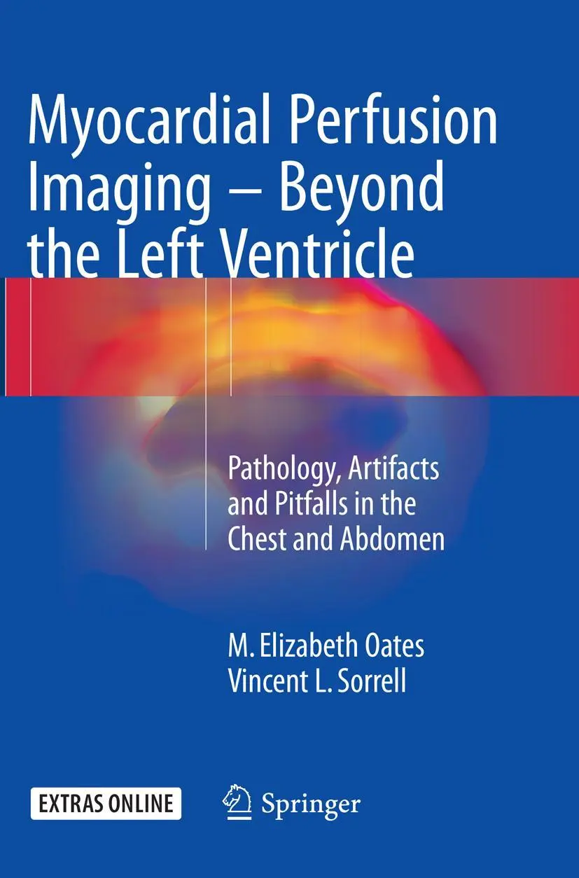 Cover: 9783319797892 | Myocardial Perfusion Imaging - Beyond the Left Ventricle | Taschenbuch