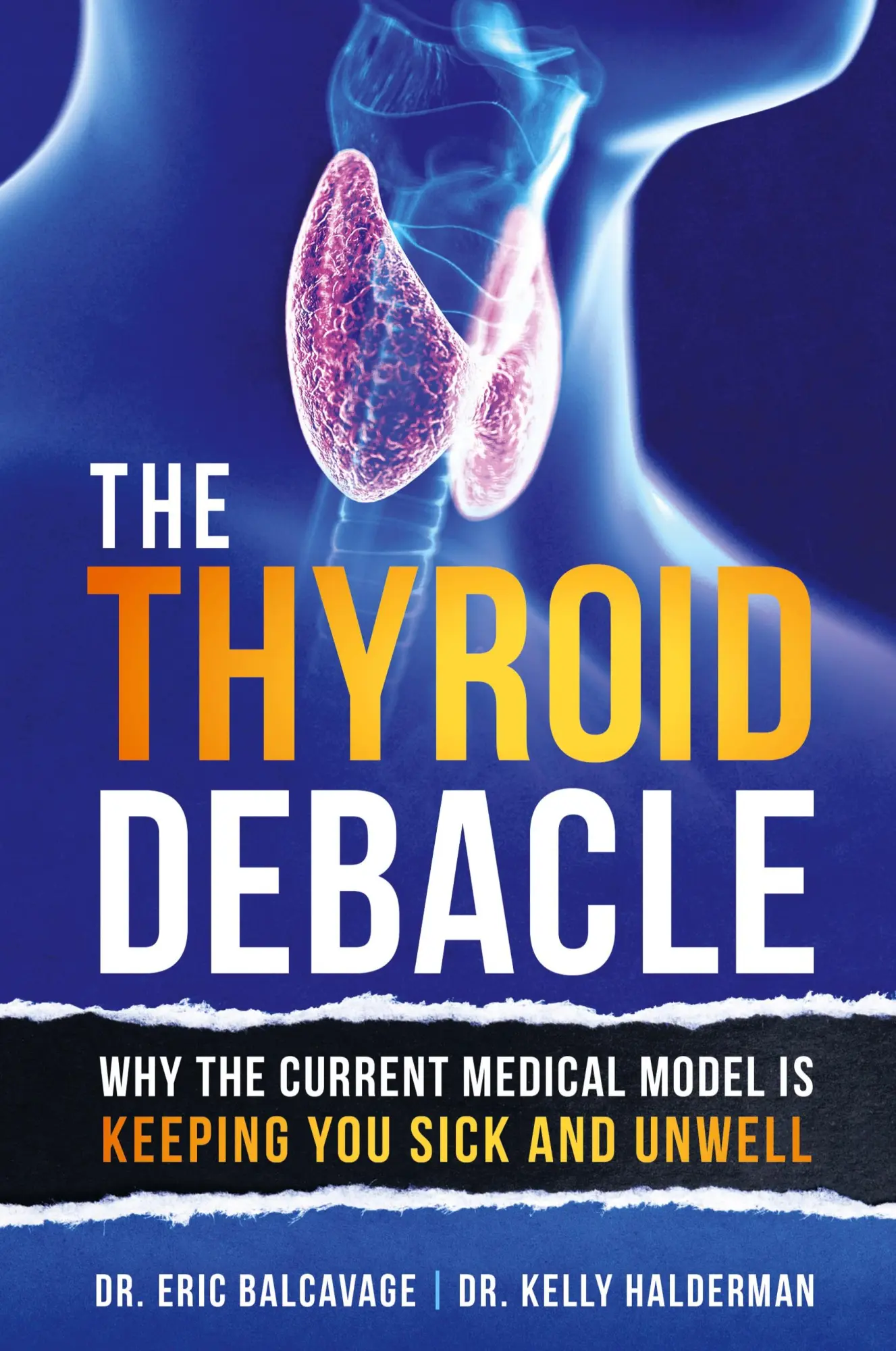 Cover: 9798765227992 | The Thyroid Debacle | Eric Balcavage (u. a.) | Taschenbuch | Englisch