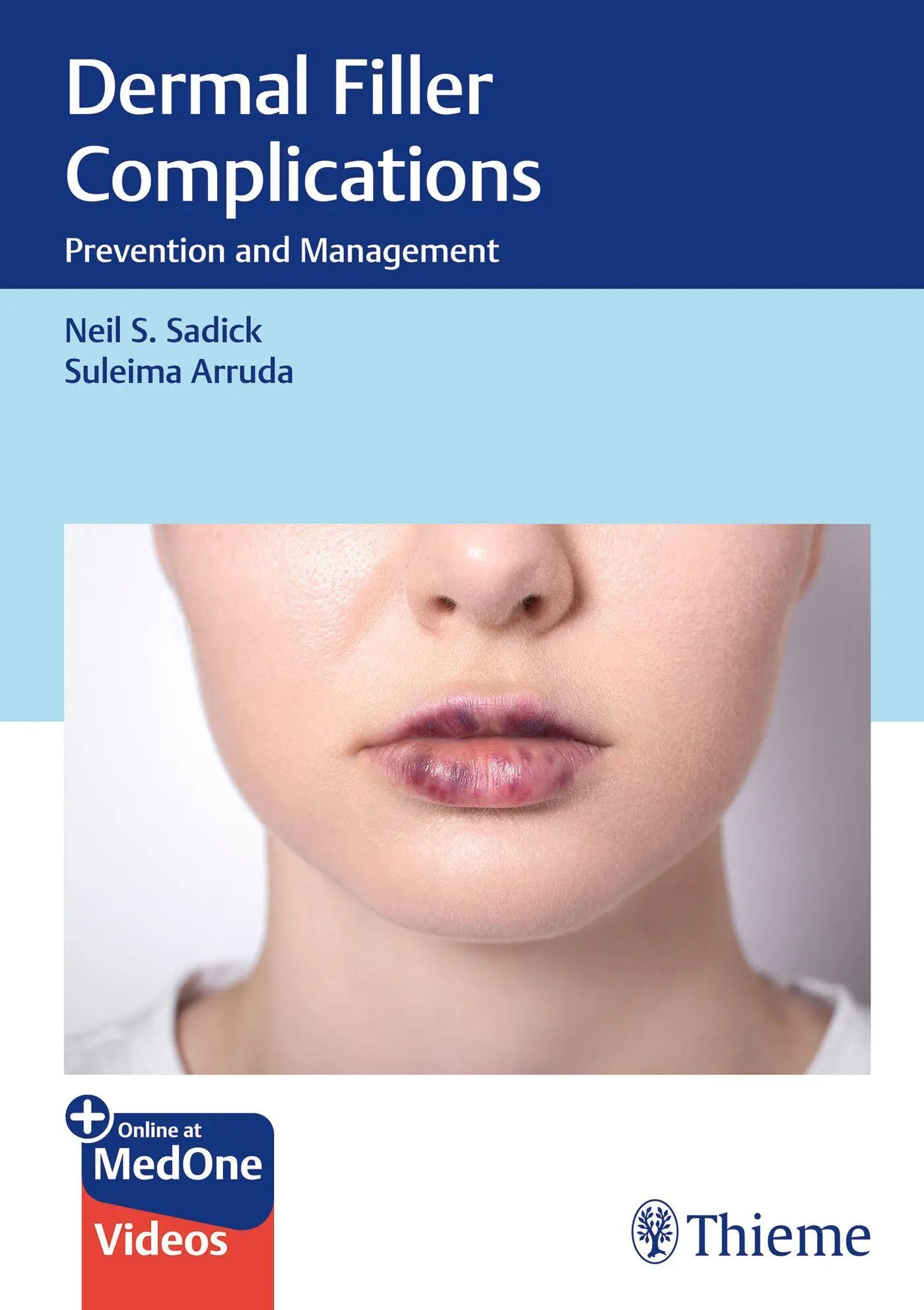 Cover: 9783132428492 | Dermal Filler Complications | Prevention and Management | Bundle