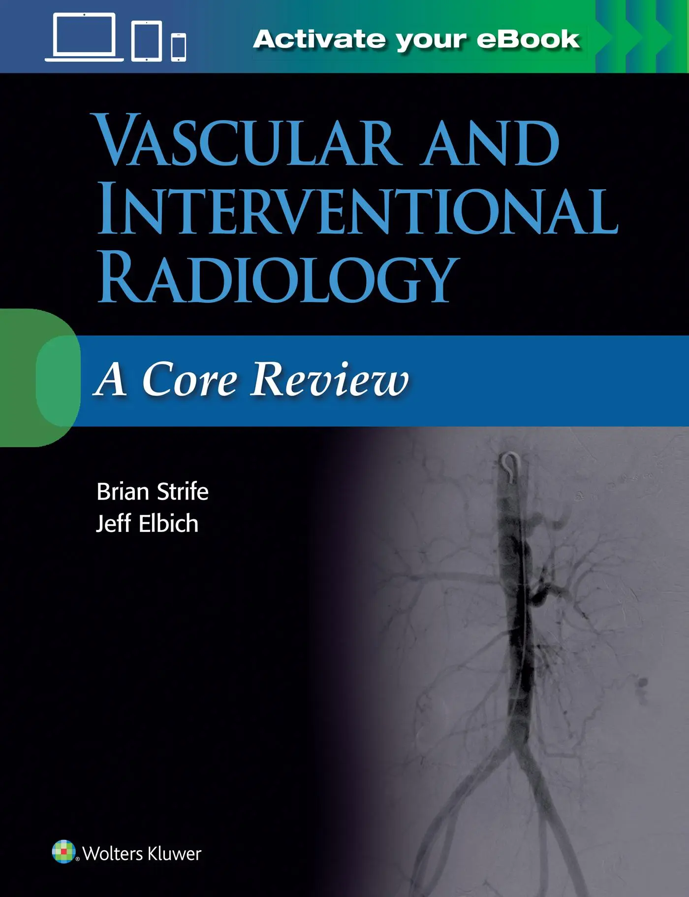 Cover: 9781496384393 | Vascular and Interventional Radiology: A Core Review | Strife (u. a.)