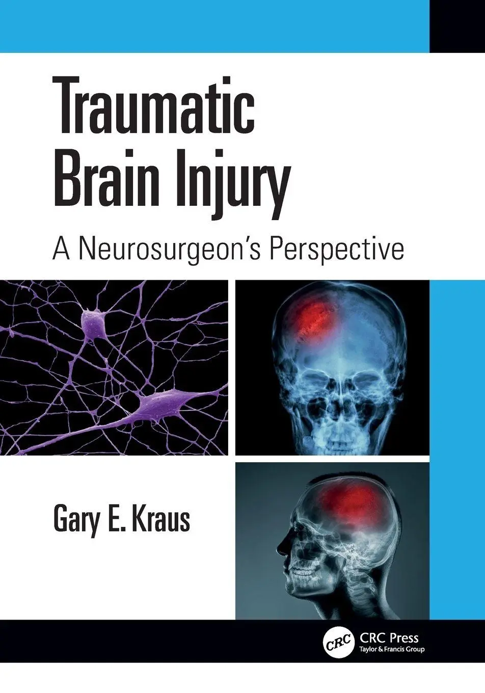 Cover: 9781032394893 | Traumatic Brain Injury | A Neurosurgeon's Perspective | Gary E. Kraus