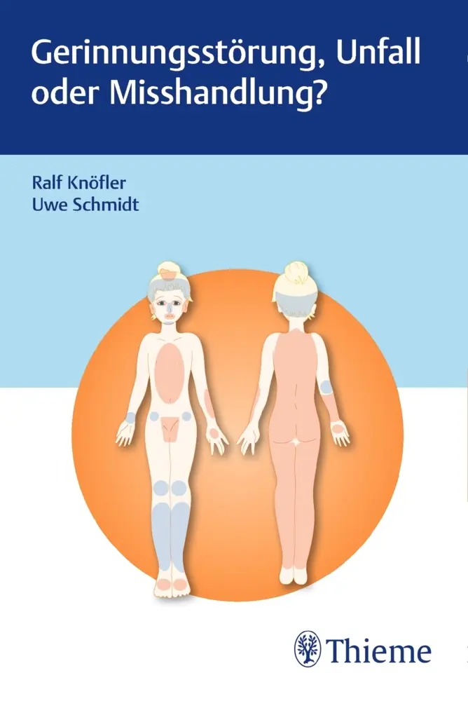 Cover: 9783132427693 | Gerinnungsstörung, Unfall oder Misshandlung? | Taschenbuch | 68 S.