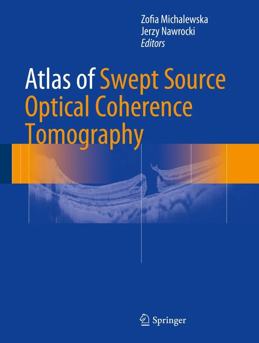 Cover: 9783319498393 | Atlas of Swept Source Optical Coherence Tomography | Nawrocki (u. a.)