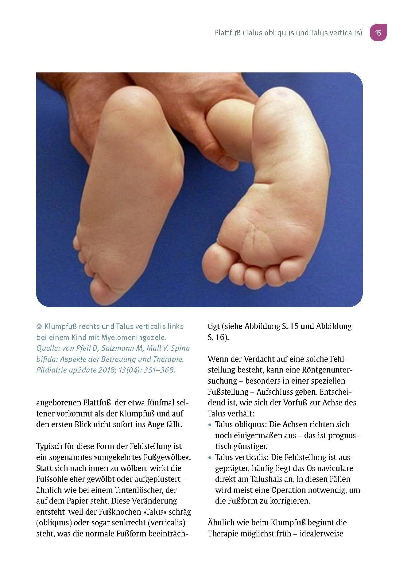 Bild: 9783432120294 | Aus der Praxis eines Kinderorthopäden | Sébastien Hagmann | Buch