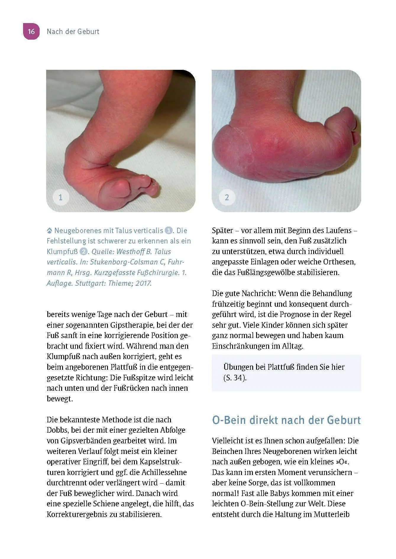 Bild: 9783432120294 | Aus der Praxis eines Kinderorthopäden | Sébastien Hagmann | Buch